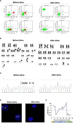 Frontiers | Case Report: Blinatumomab Therapy For The Treatment Of B ...